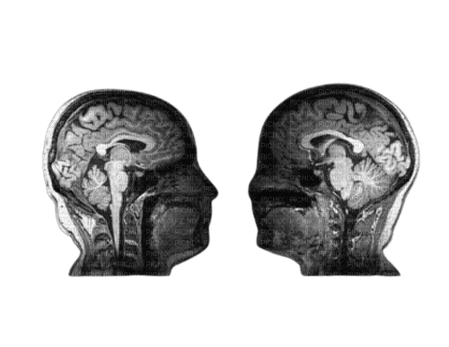 brain scan png - nemokama png